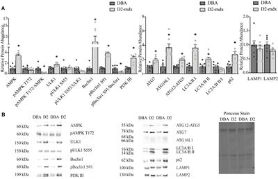 Indices of Defective Autophagy in Whole Muscle and Lysosome Enriched Fractions From Aged D2-mdx Mice